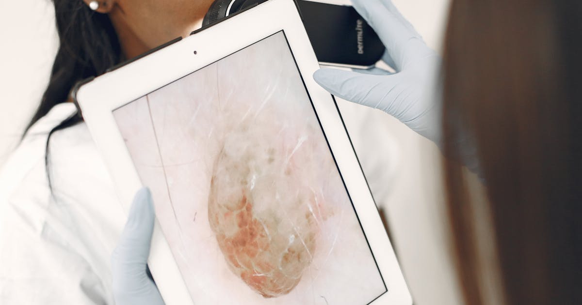 AI in Cancer Detection How Machine Learning Boosts Early Diagnosis