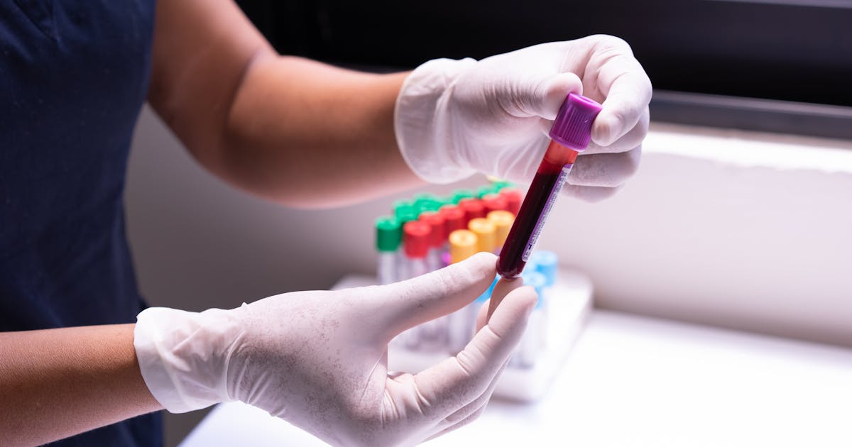 Hidden Added Sugars in Processed Foods Fuel Metabolic Syndrome Crisis