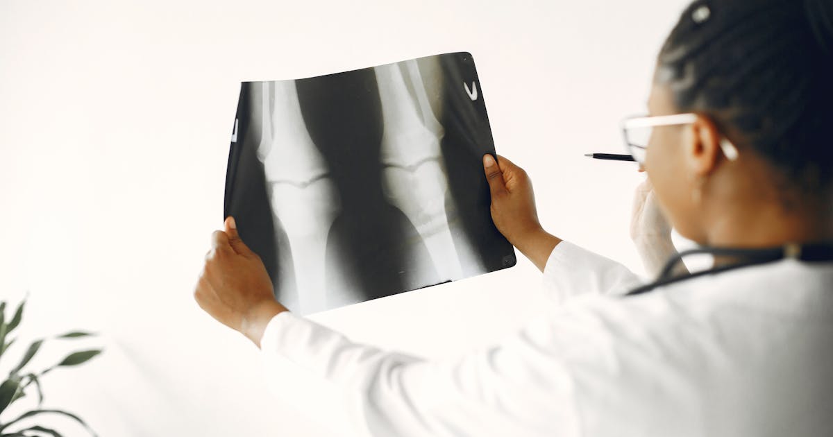 Recognizing Early Osteoarthritis Signs and Joint Preservation Tactics