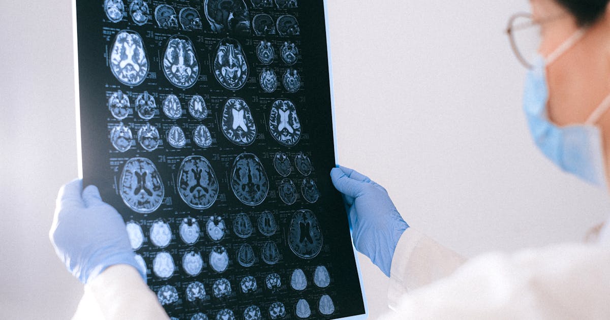 Mindfulness Meditation Reshapes the Brain: How MBSR Programs Create Lasting Change