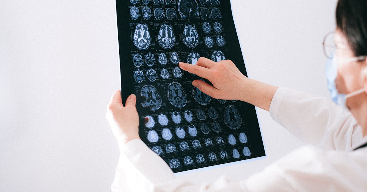 Omega-3 Fatty Acids and Brain Health: Preventing Cognitive Decline Naturally