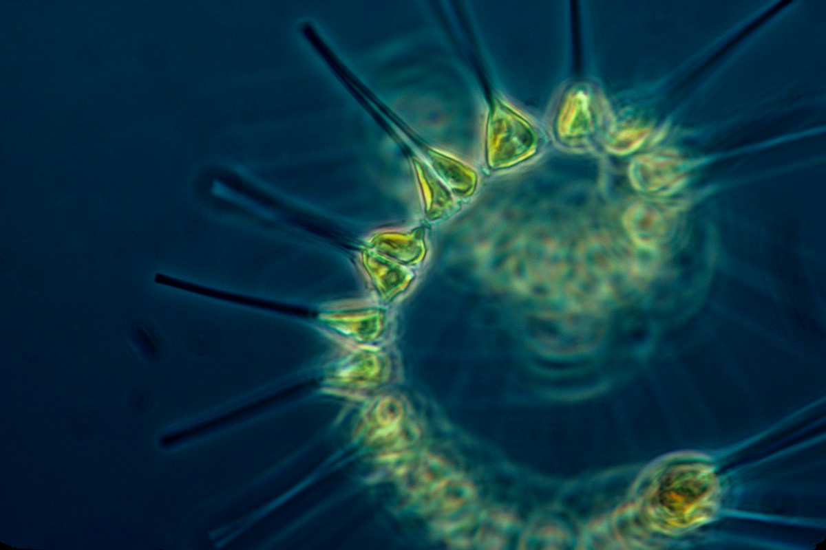 Mitochondrial Heteroplasmy and Mitophagy Dynamics: Mitochondrial DNA Mutations, PINK1-Parkin Cascades, and Age-Related Degeneration